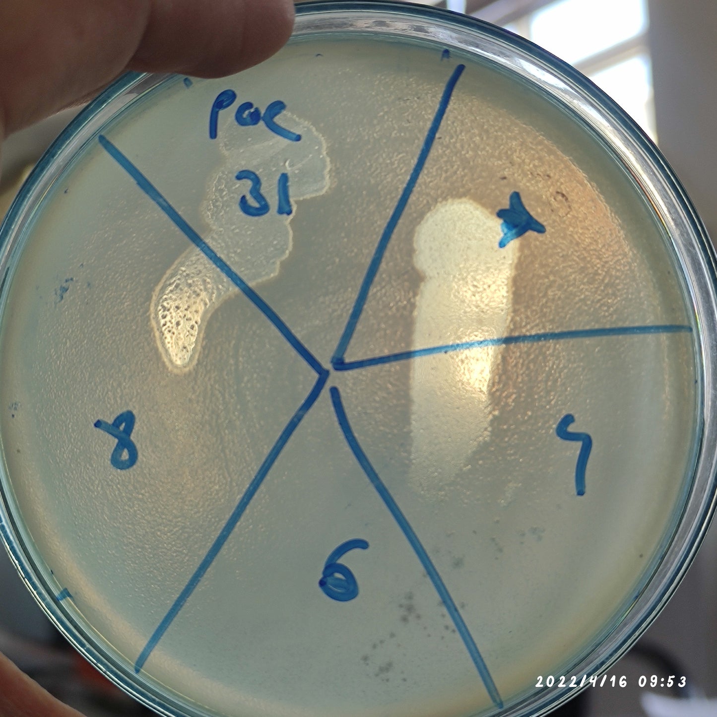 Pseudomonas aeruginosa bacteriophage 130031D