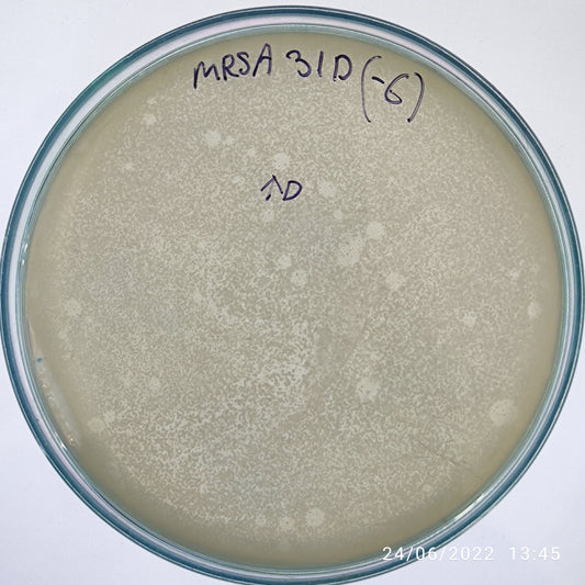 Staphylococcus aureus bacteriophage 150031D