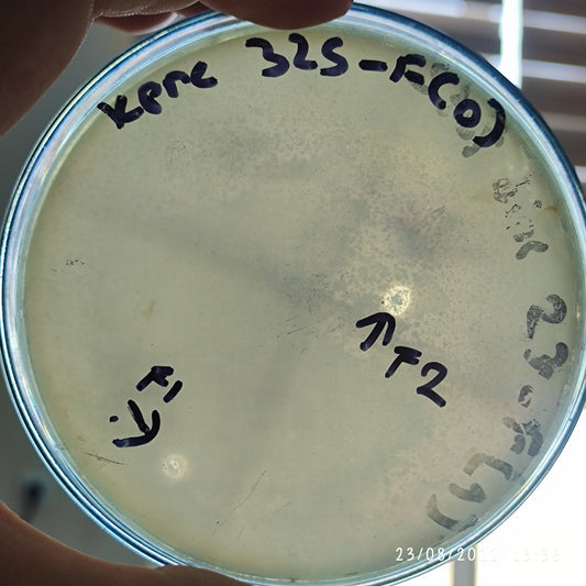 Klebsiella pneumoniae bacteriophage 180325F