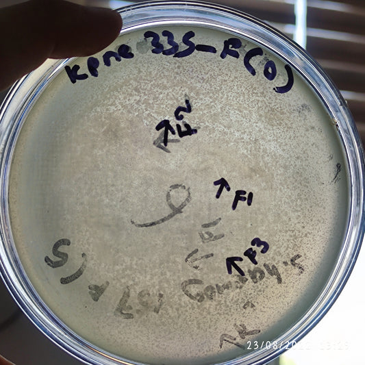 Klebsiella pneumoniae bacteriophage 180335F