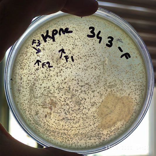 Klebsiella pneumoniae bacteriophage 180343F