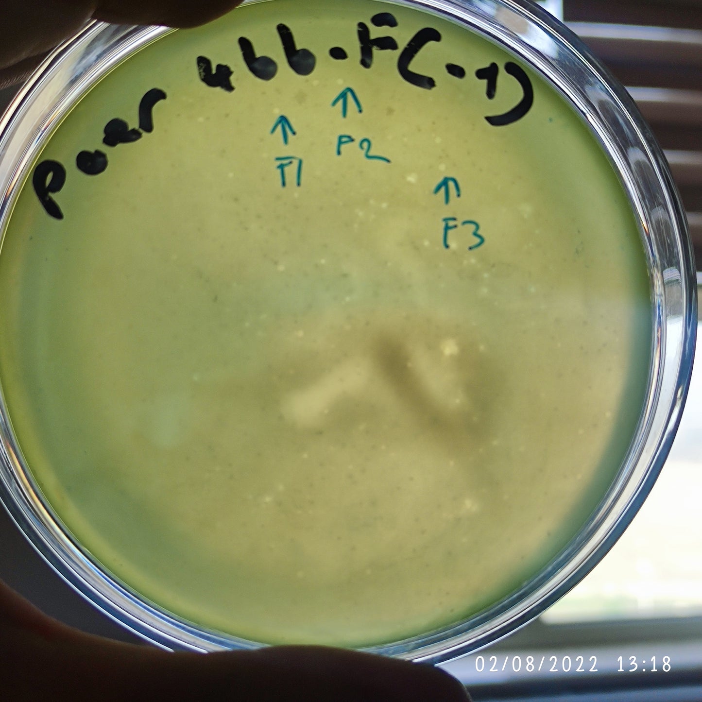 Pseudomonas aeruginosa bacteriophage 130466F