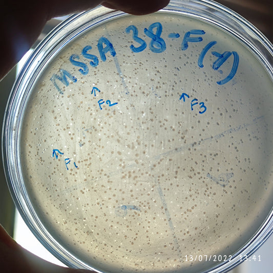 Staphylococcus aureus bacteriophage 152038F