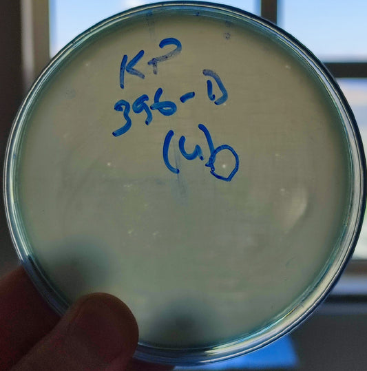 Klebsiella pneumoniae bacteriophage 180396D