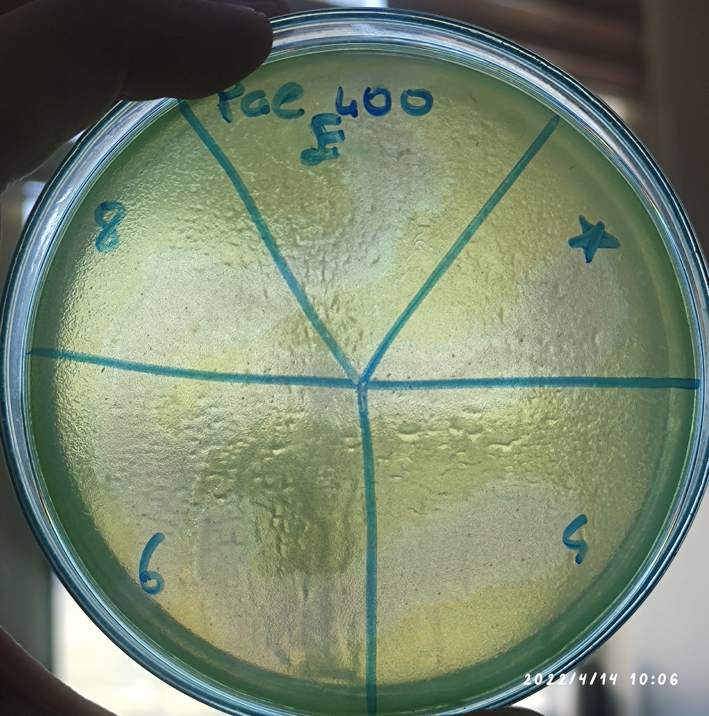 Pseudomonas aeruginosa bacteriophage 130400E