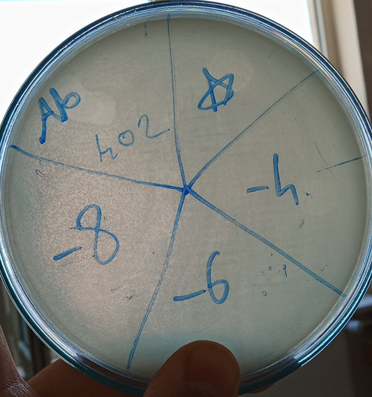 Acinetobacter baumannii bacteriophage 120402A