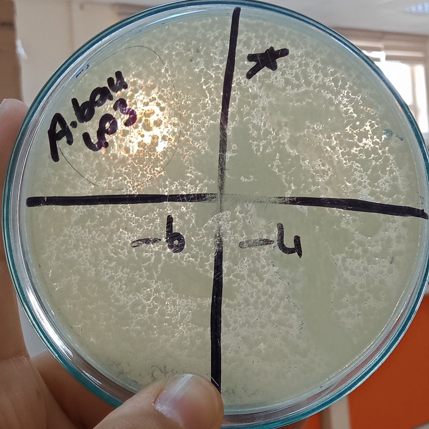 Acinetobacter baumannii bacteriophage 120403A