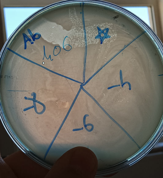 Acinetobacter baumannii bacteriophage 120406A