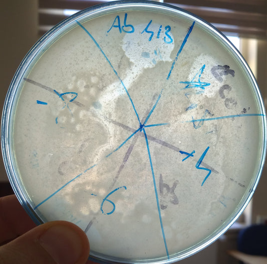 Acinetobacter baumannii bacteriophage 120413A