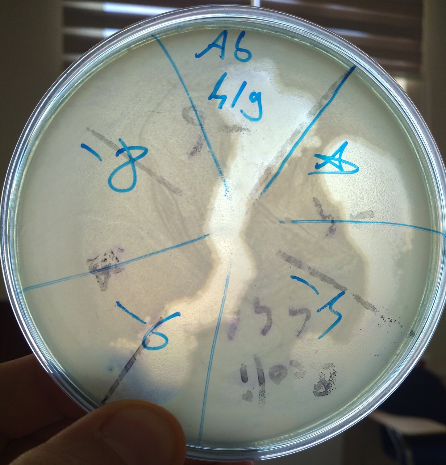 Acinetobacter baumannii bacteriophage 120419A