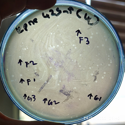 Klebsiella pneumoniae bacteriophage 180425G