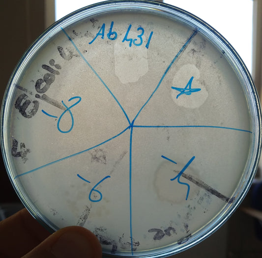 Acinetobacter baumannii bacteriophage 120431A