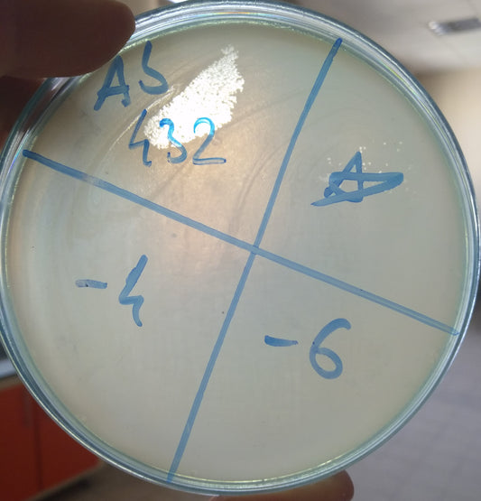 Acinetobacter baumannii bacteriophage 120432A