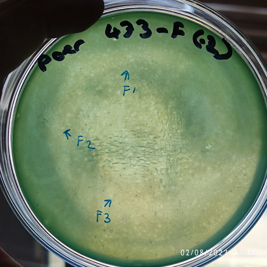 Pseudomonas aeruginosa bacteriophage 130473F