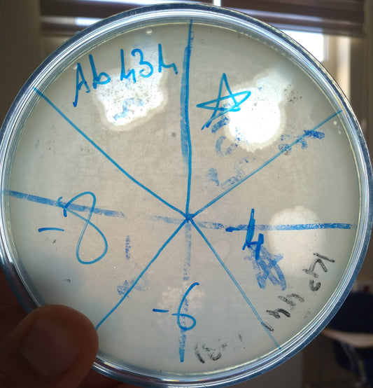 Acinetobacter baumannii bacteriophage 120434A