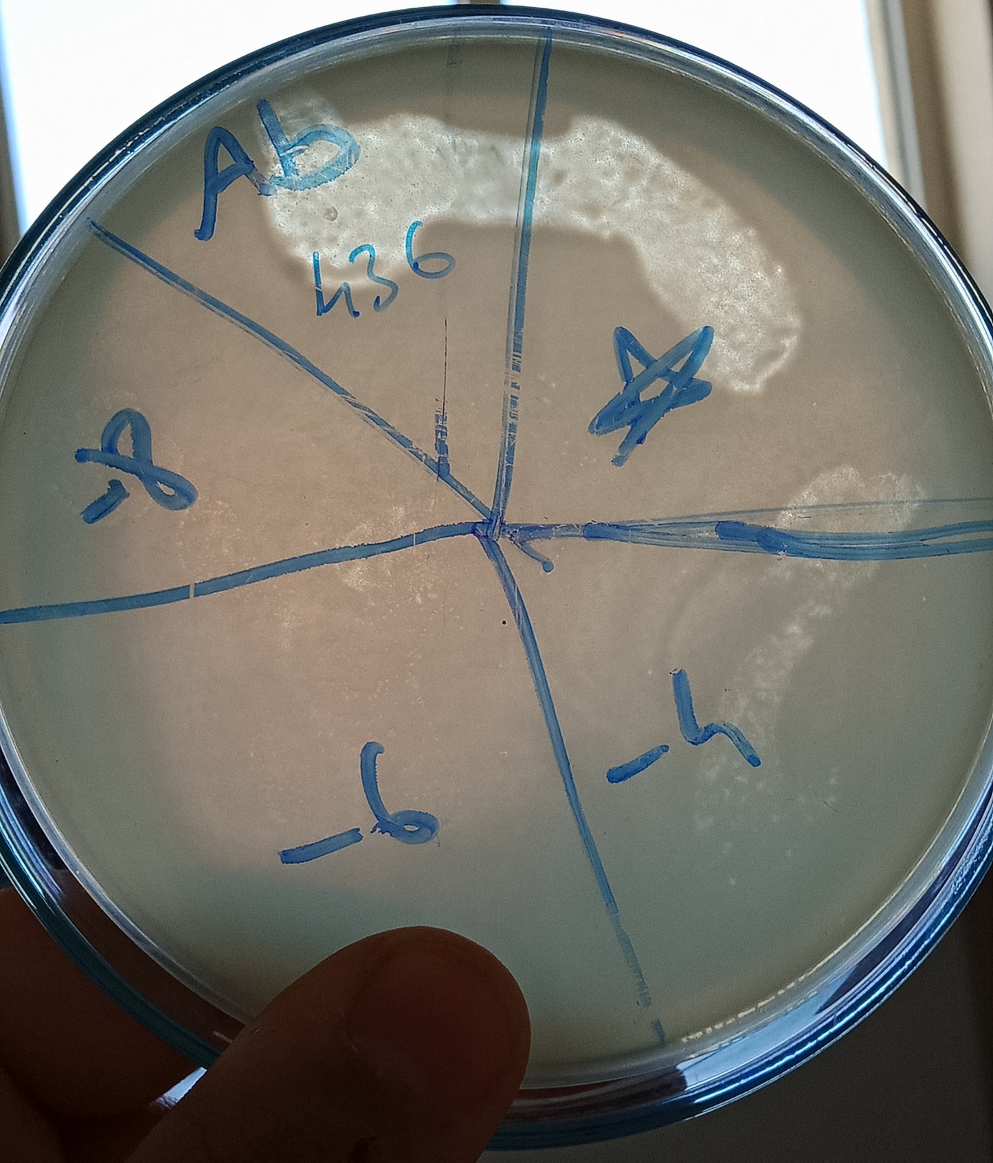 Acinetobacter baumannii bacteriophage 120436A