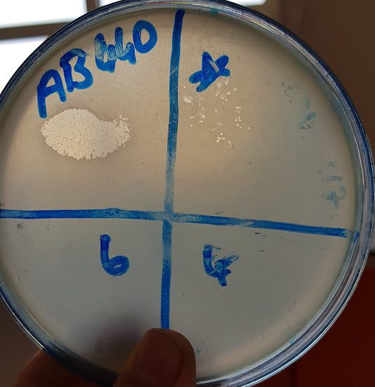 Acinetobacter baumannii bacteriophage 120440A