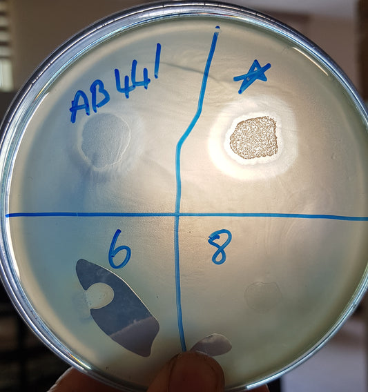 Acinetobacter baumannii bacteriophage 120441A