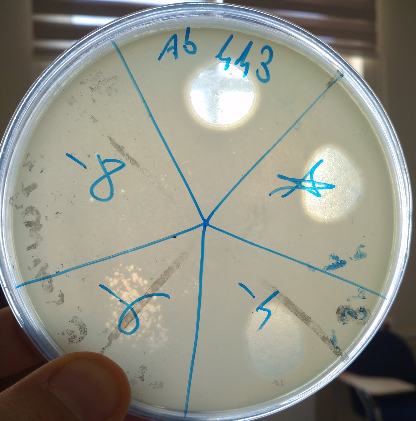 Acinetobacter baumannii bacteriophage 120443A