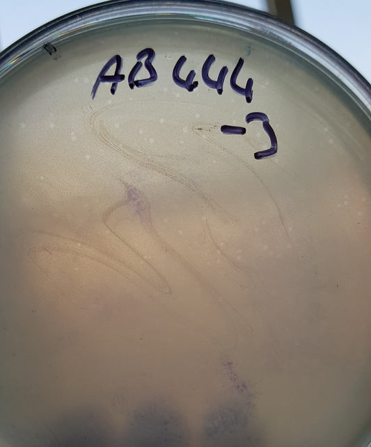 Acinetobacter baumannii bacteriophage 120444A