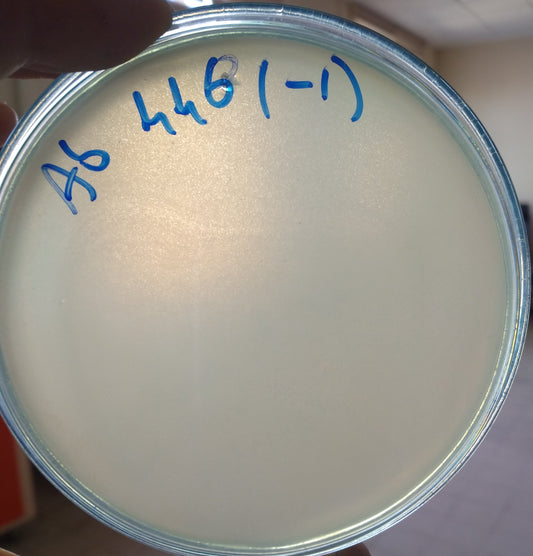 Acinetobacter baumannii bacteriophage 120446B