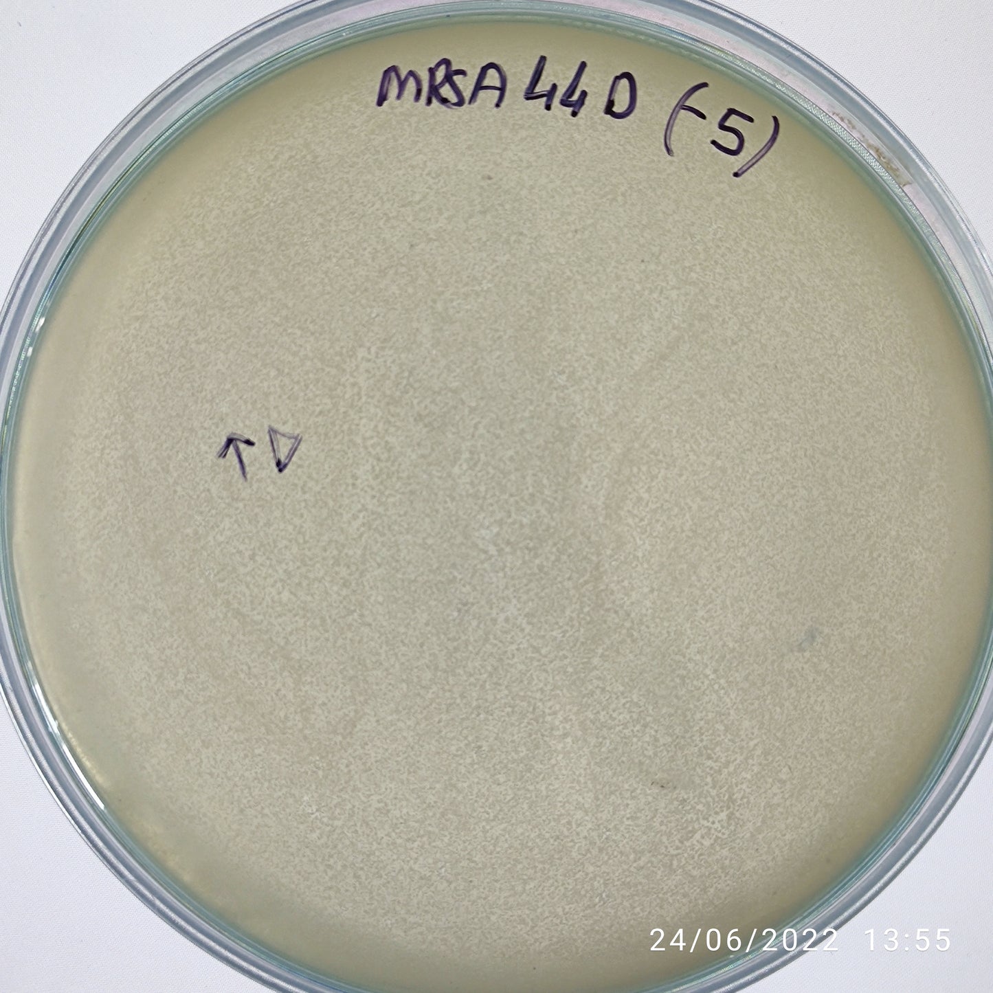 Staphylococcus aureus bacteriophage 150044D