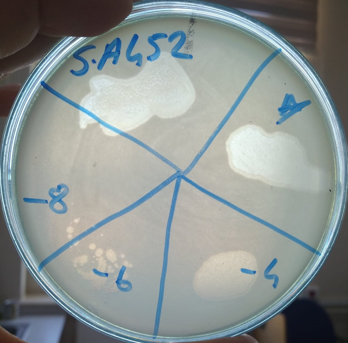 Acinetobacter baumannii bacteriophage 120452A