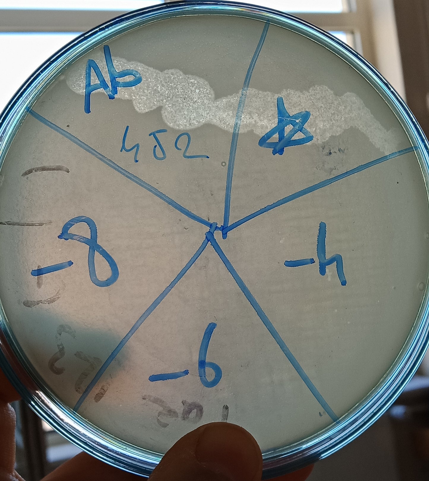 Acinetobacter baumannii bacteriophage 120452B