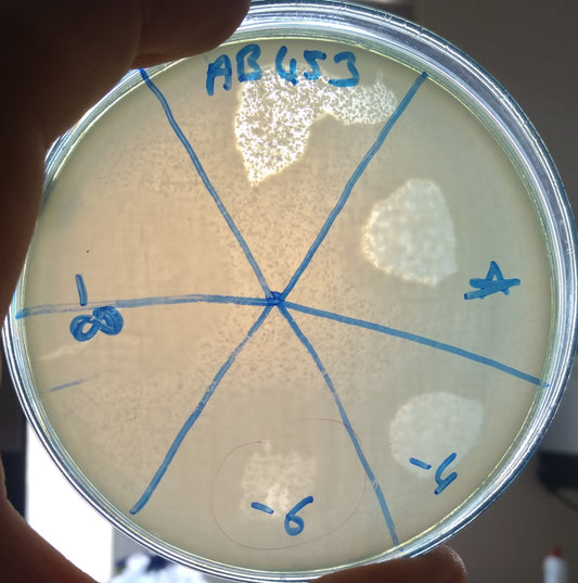 Acinetobacter baumannii bacteriophage 120453A