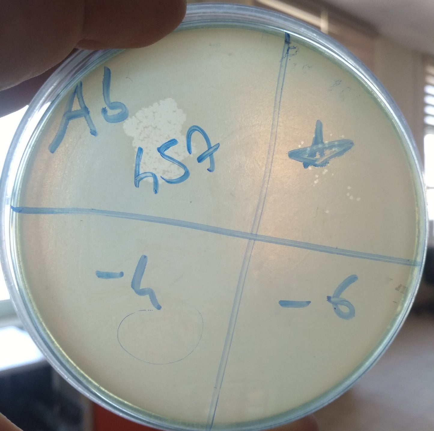 Acinetobacter baumannii bacteriophage 120457A