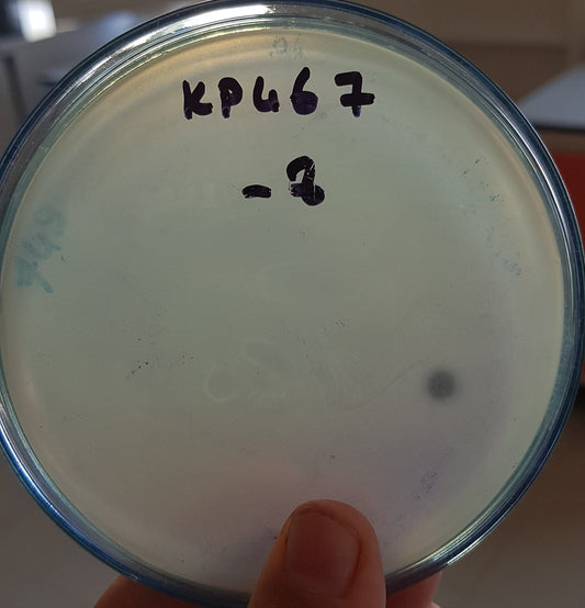 Klebsiella pneumoniae bacteriophage 180467A