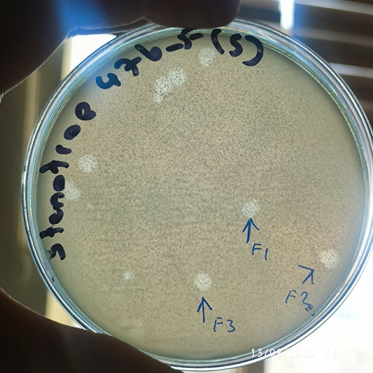 Stenotrophomonas maltophilia bacteriophage 200476F