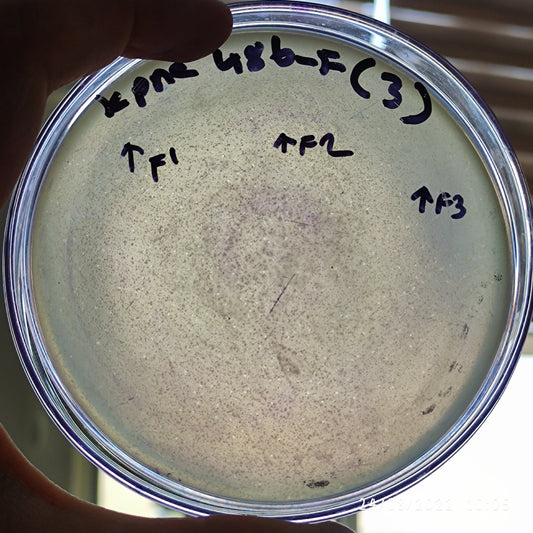 Klebsiella pneumoniae bacteriophage 180486F