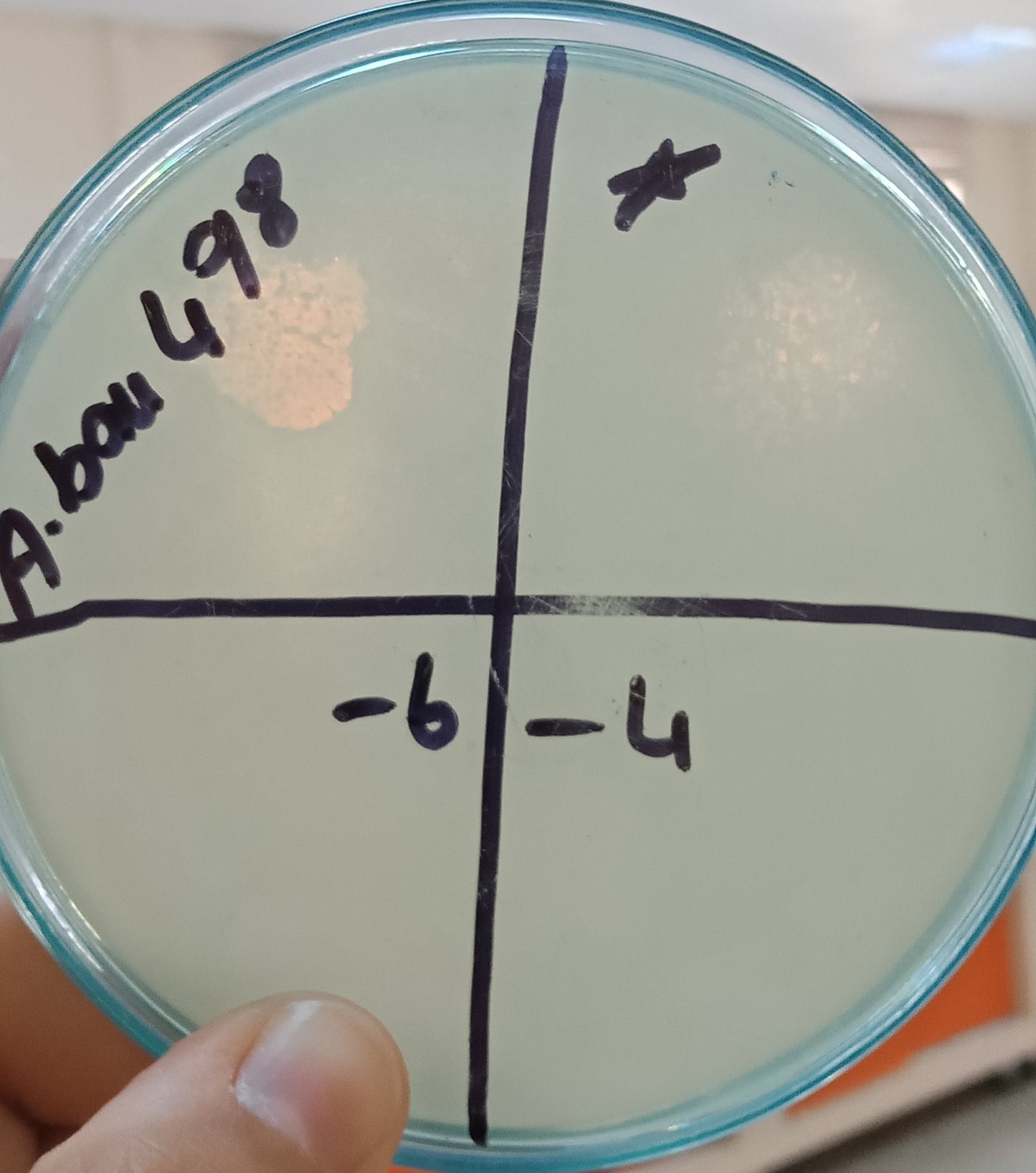 Acinetobacter baumannii bacteriophage 120498A