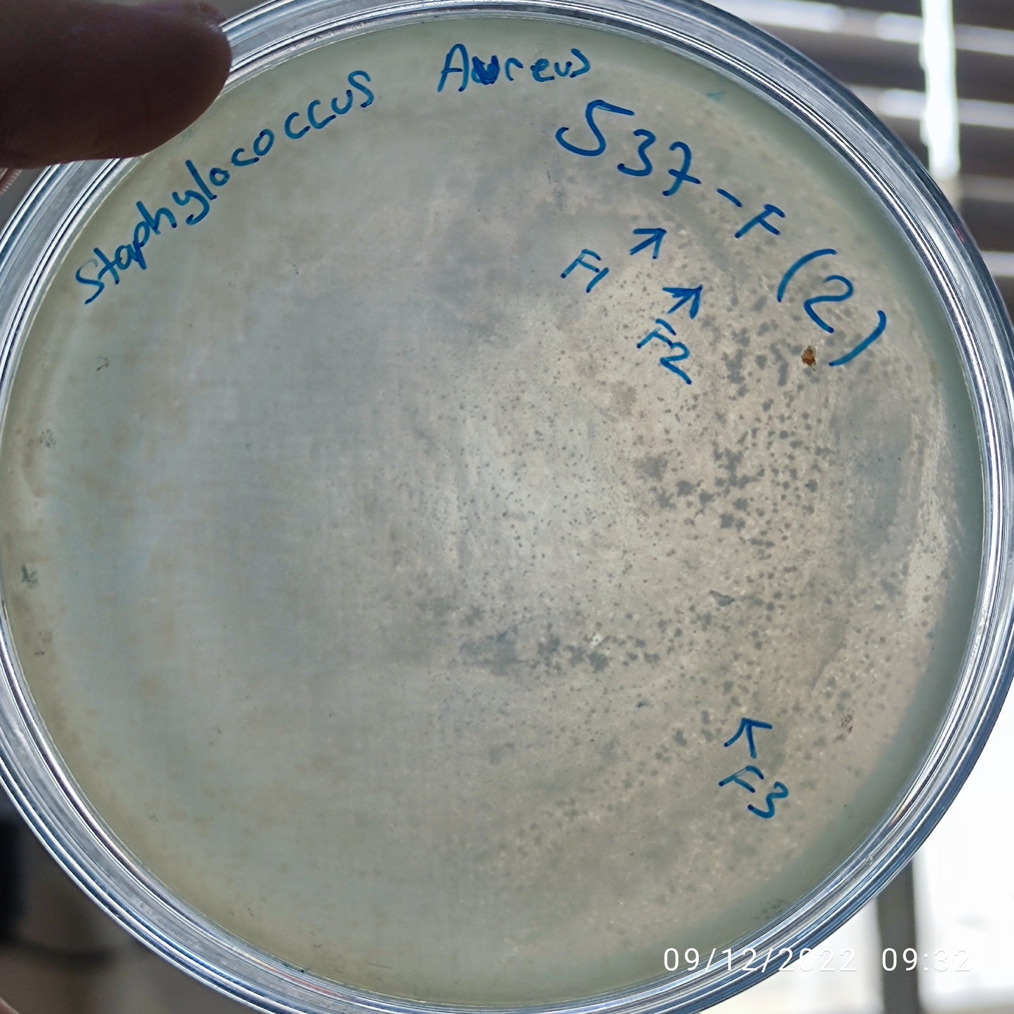 Staphylococcus aureus bacteriophage 152537F