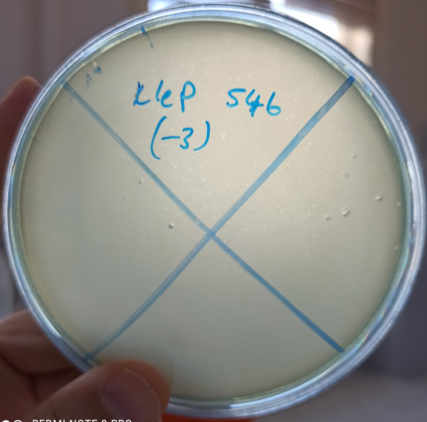 Klebsiella pneumoniae bacteriophage 180546A