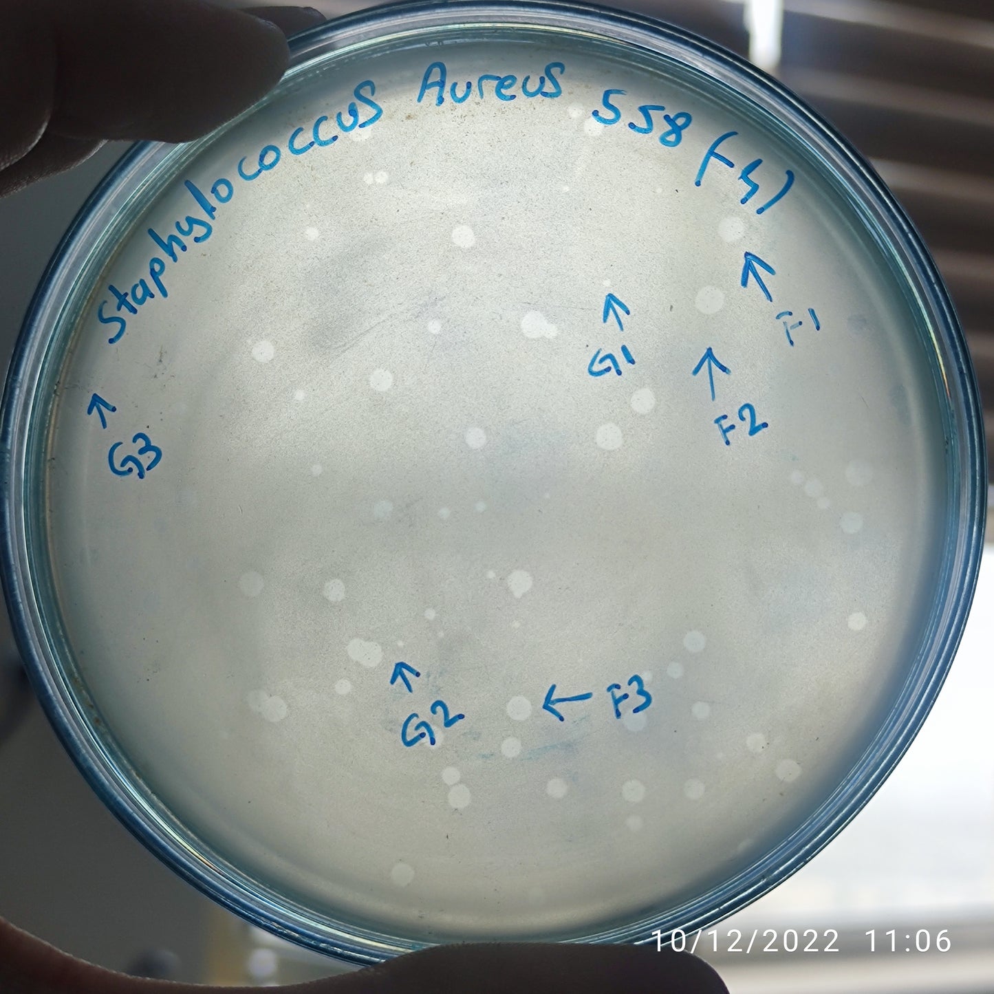 Staphylococcus aureus bacteriophage 152558G