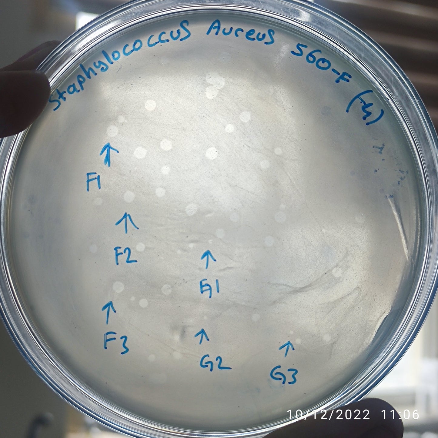 Staphylococcus aureus bacteriophage 152560F