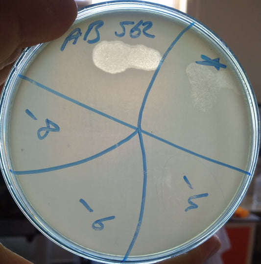 Acinetobacter baumannii bacteriophage 120562A