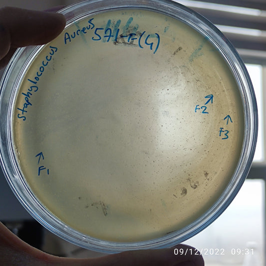 Staphylococcus aureus bacteriophage 152571F