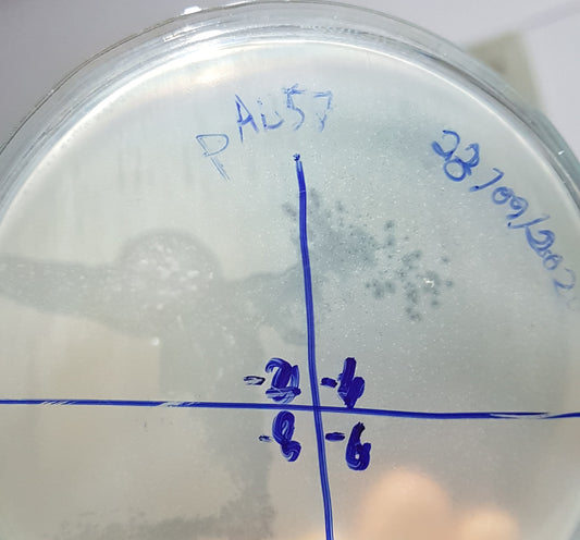 Acinetobacter baumannii bacteriophage 120057A