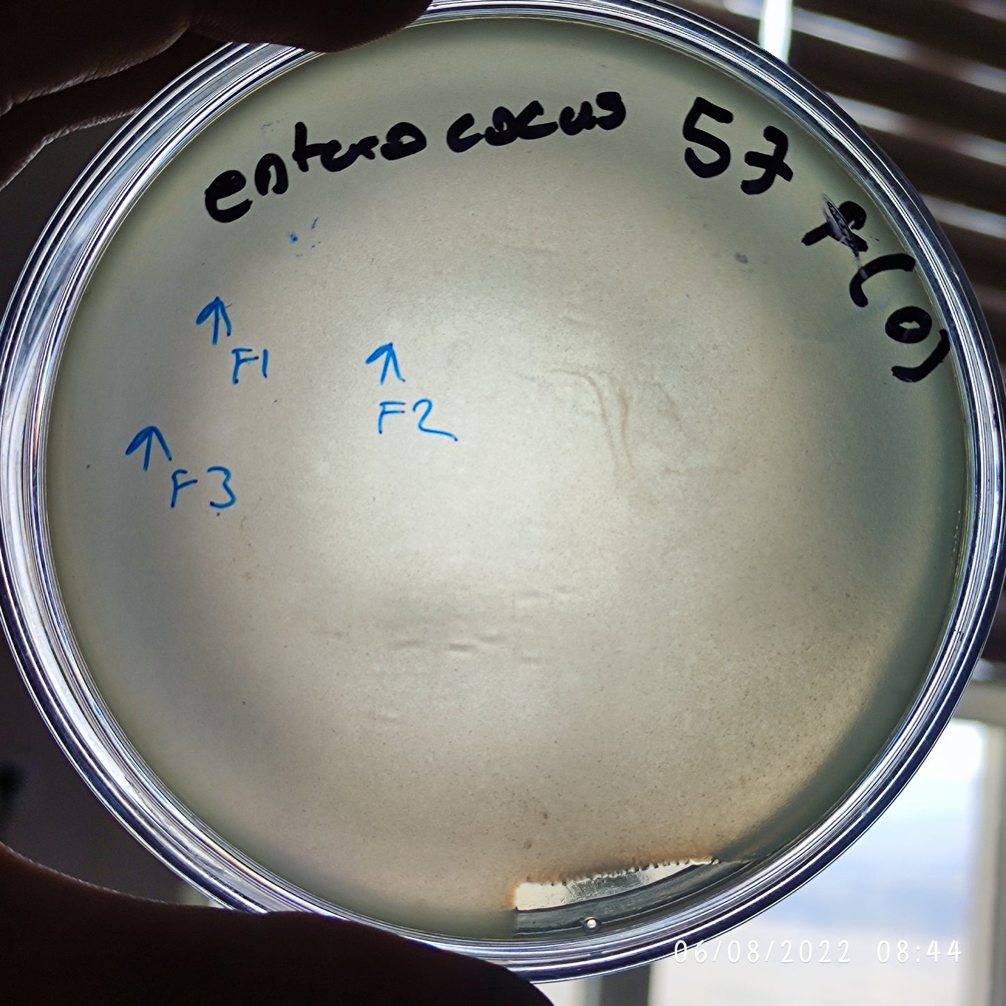 Enterococccus bacteriophage 110057F