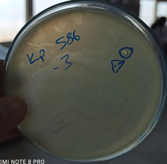 Klebsiella pneumoniae bacteriophage 180586A