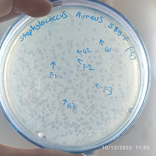 Staphylococcus aureus bacteriophage 152589F