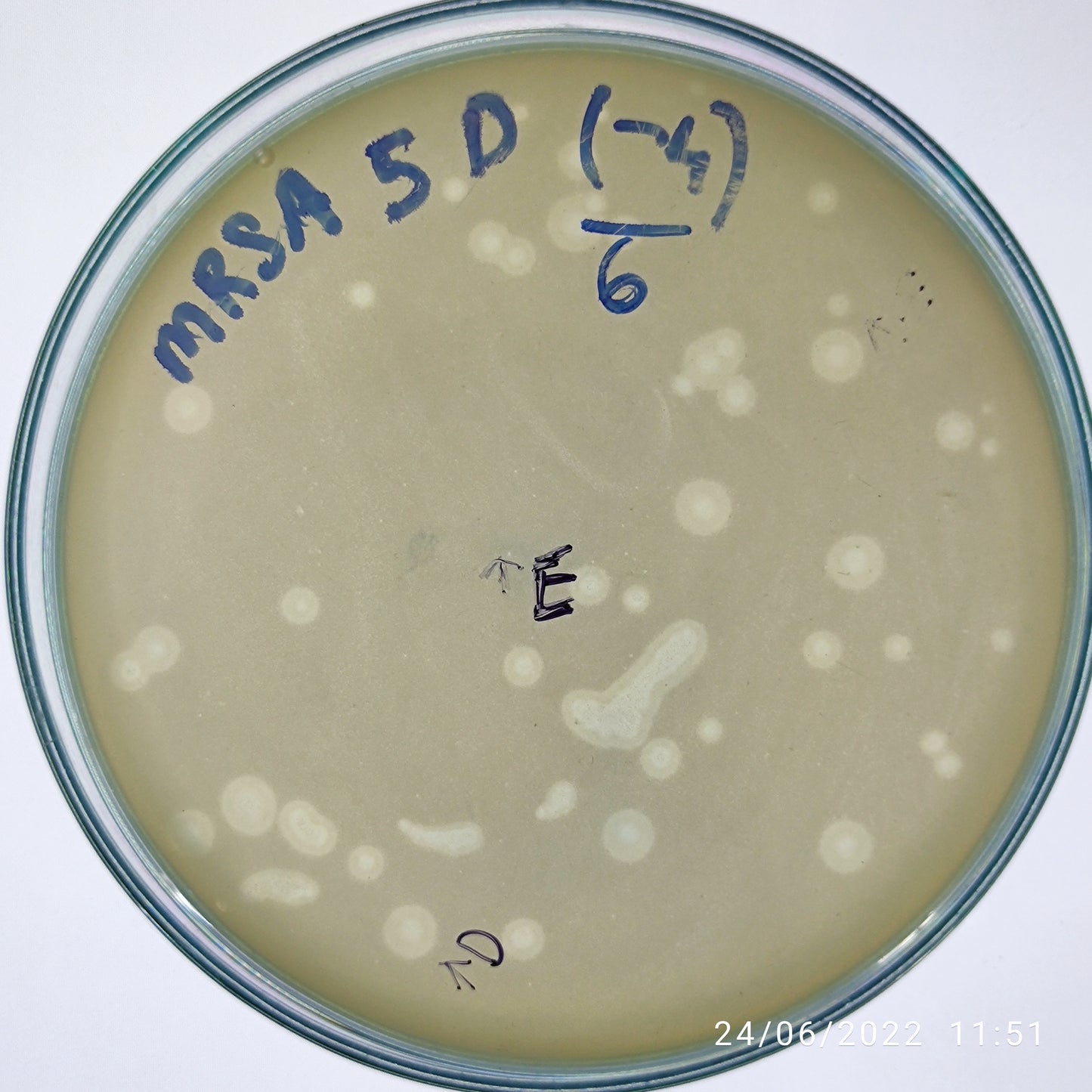 Staphylococcus aureus bacteriophage 150005D