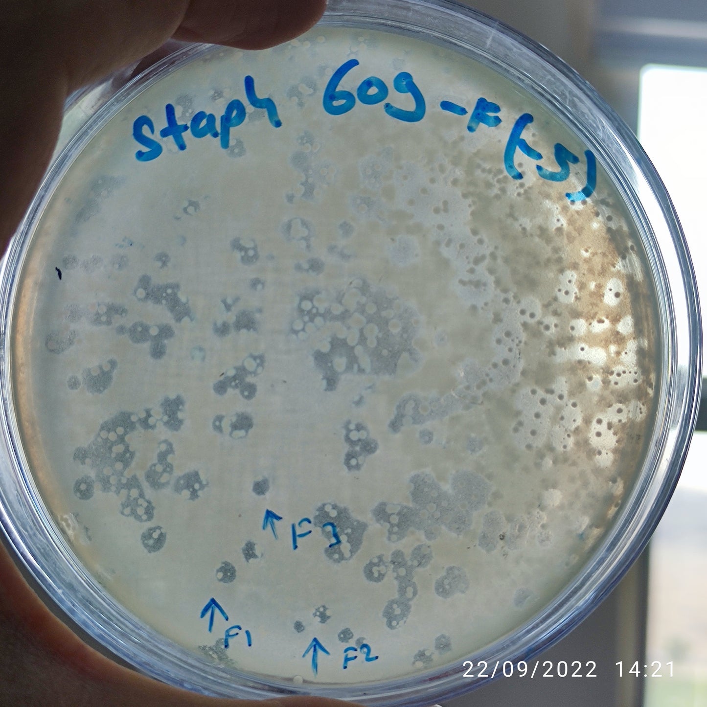 Staphylococcus aureus bacteriophage 152609F