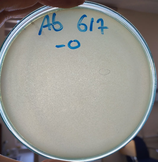 Acinetobacter baumannii bacteriophage 120617A