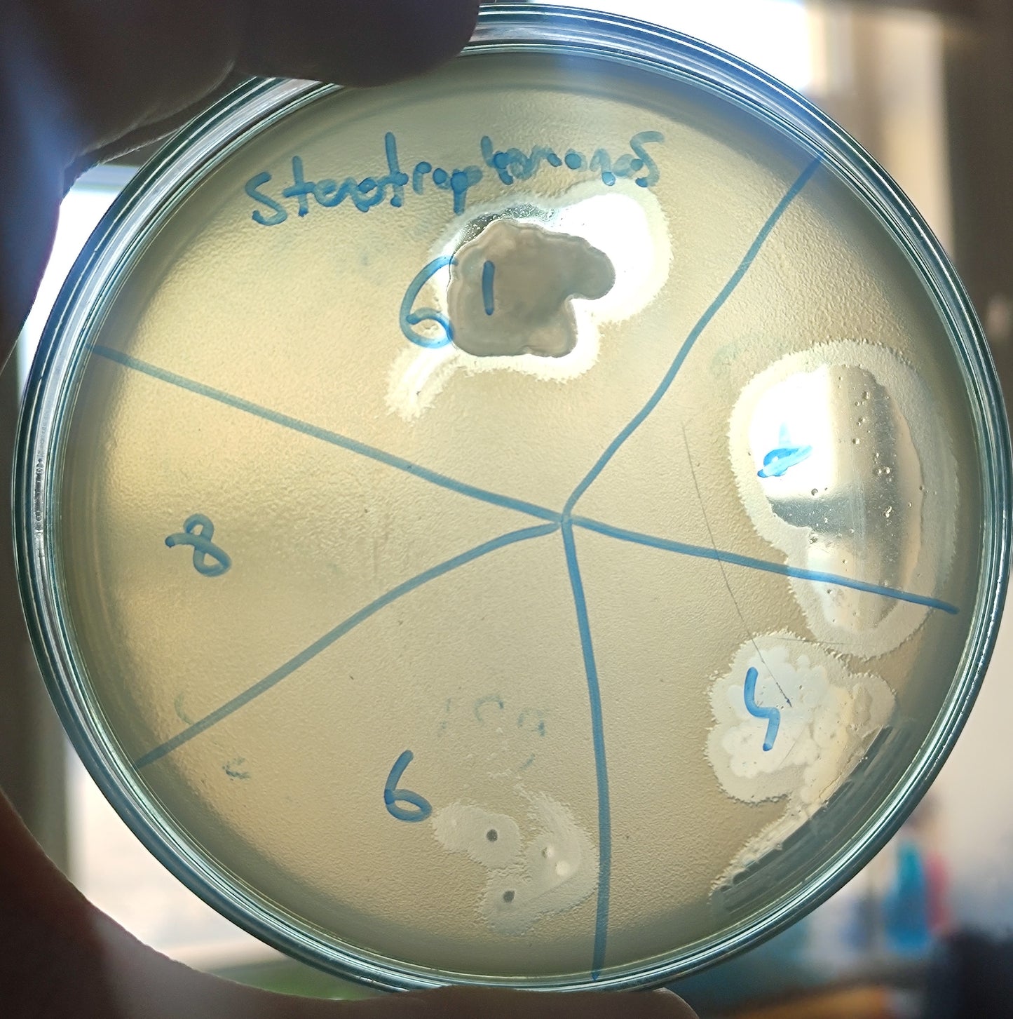 Stenotrophomonas maltophilia bacteriophage 200061D