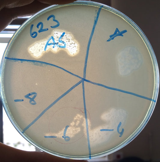 Acinetobacter baumannii bacteriophage 120623A