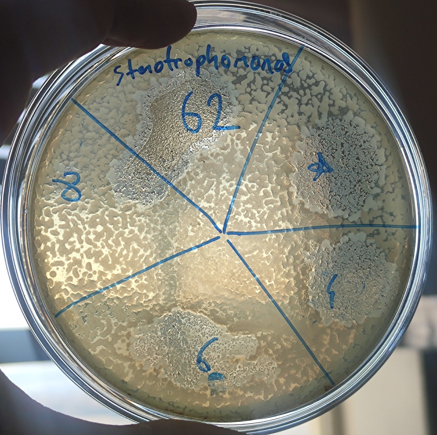 Stenotrophomonas maltophilia bacteriophage 200062D